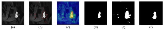 FR-PatchCore: An Industrial Anomaly Detection Method for Improving ...