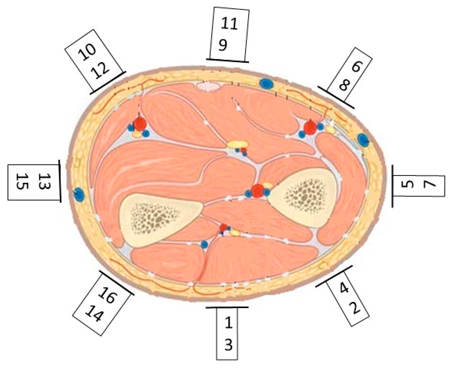 Sensors 24 01379 g013