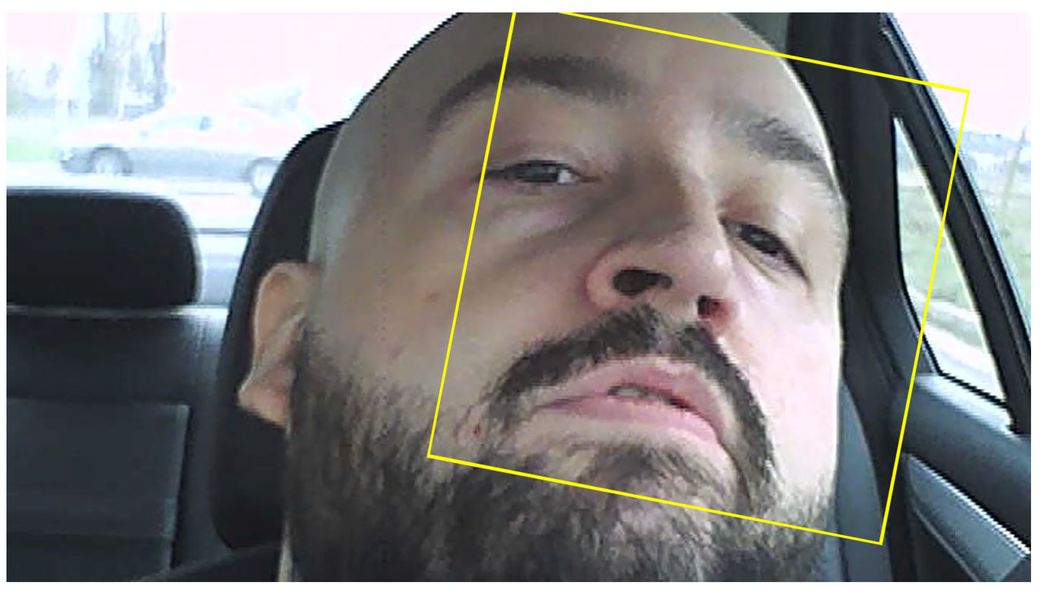 Sensors 24 01541 g011