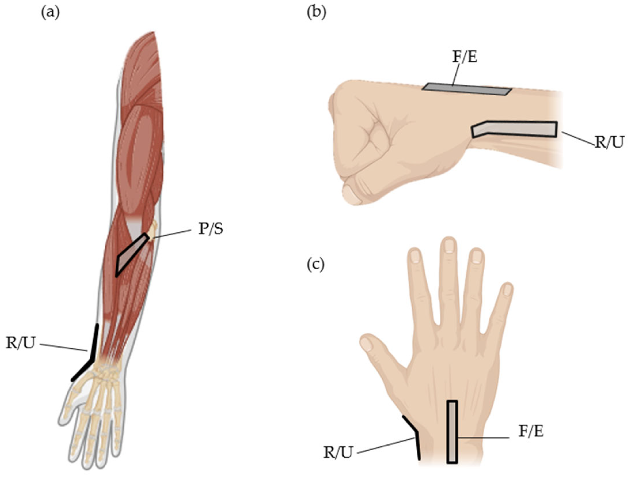 Sensors 24 01685 g004