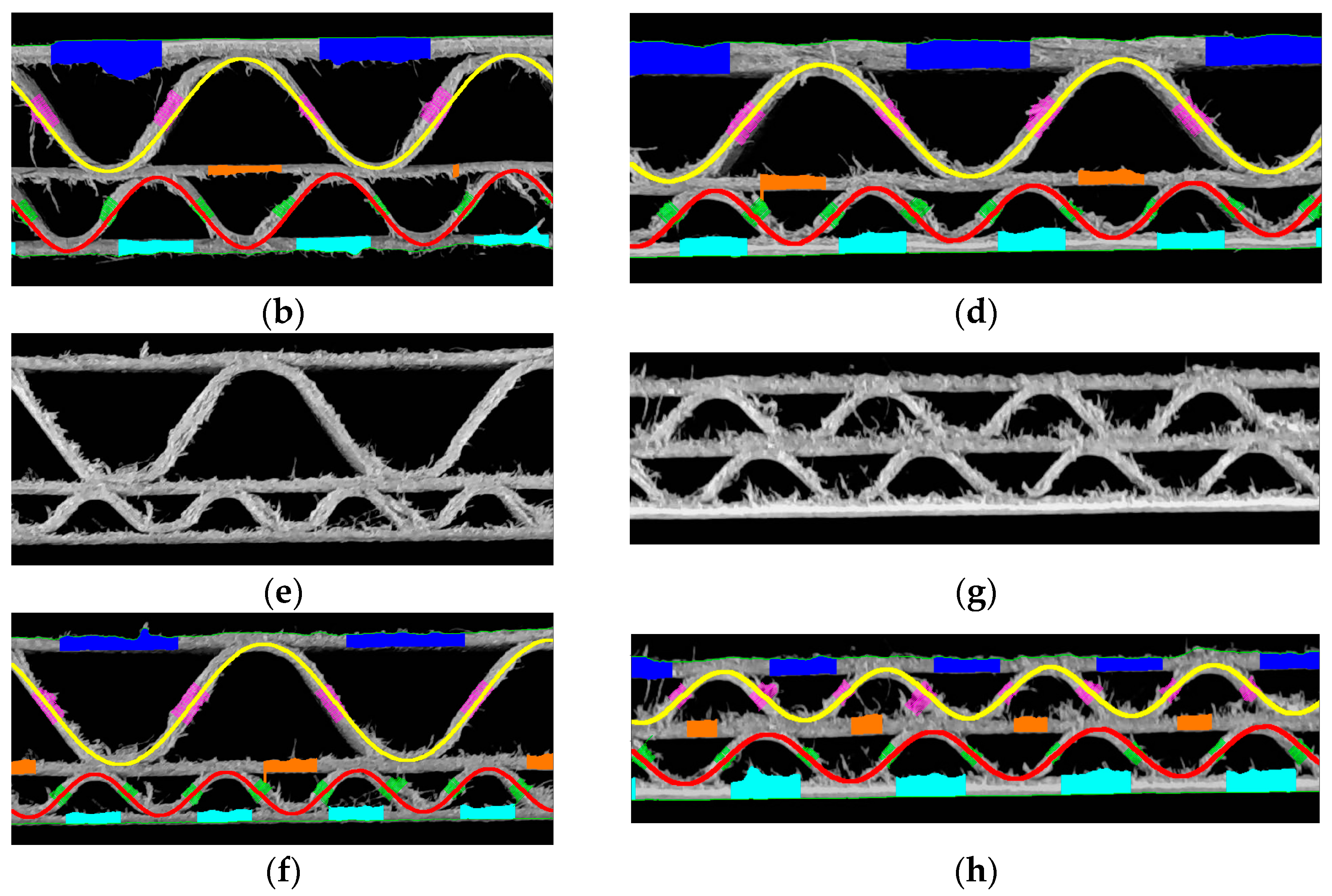 Sensors 24 01772 g013b