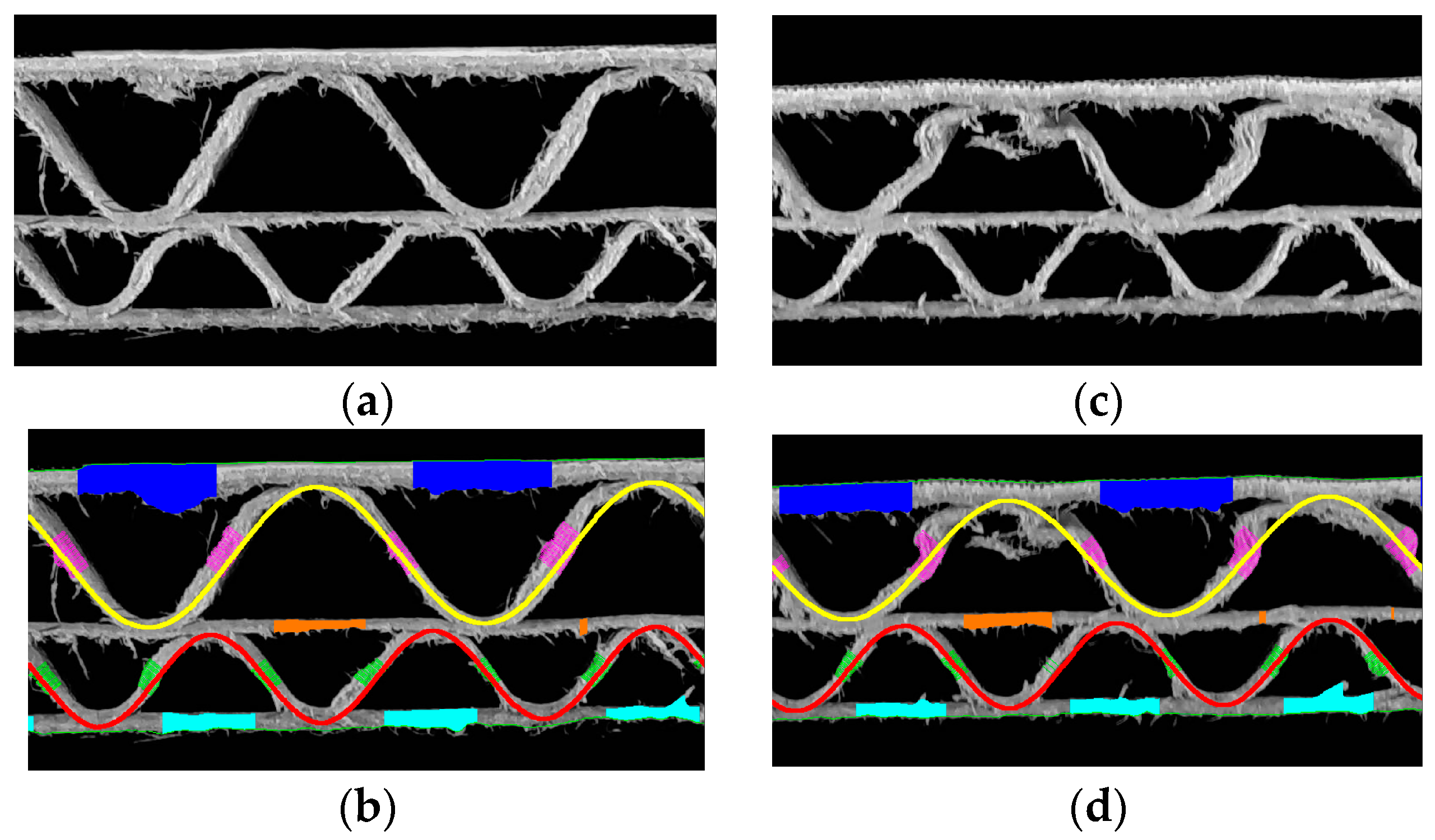 Sensors 24 01772 g014