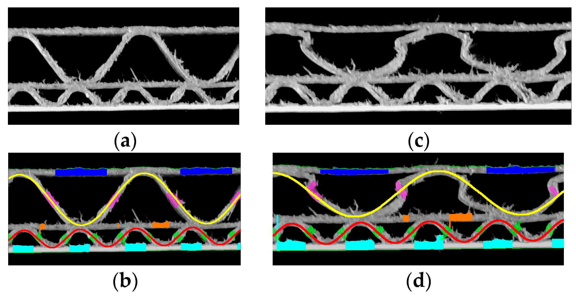 Sensors 24 01772 g016