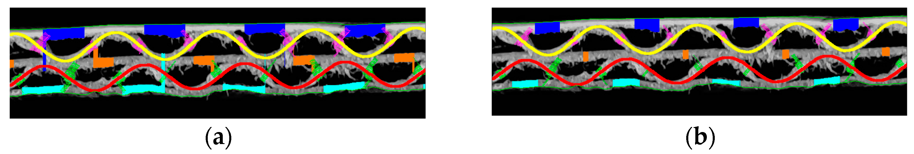 Sensors 24 01772 g020