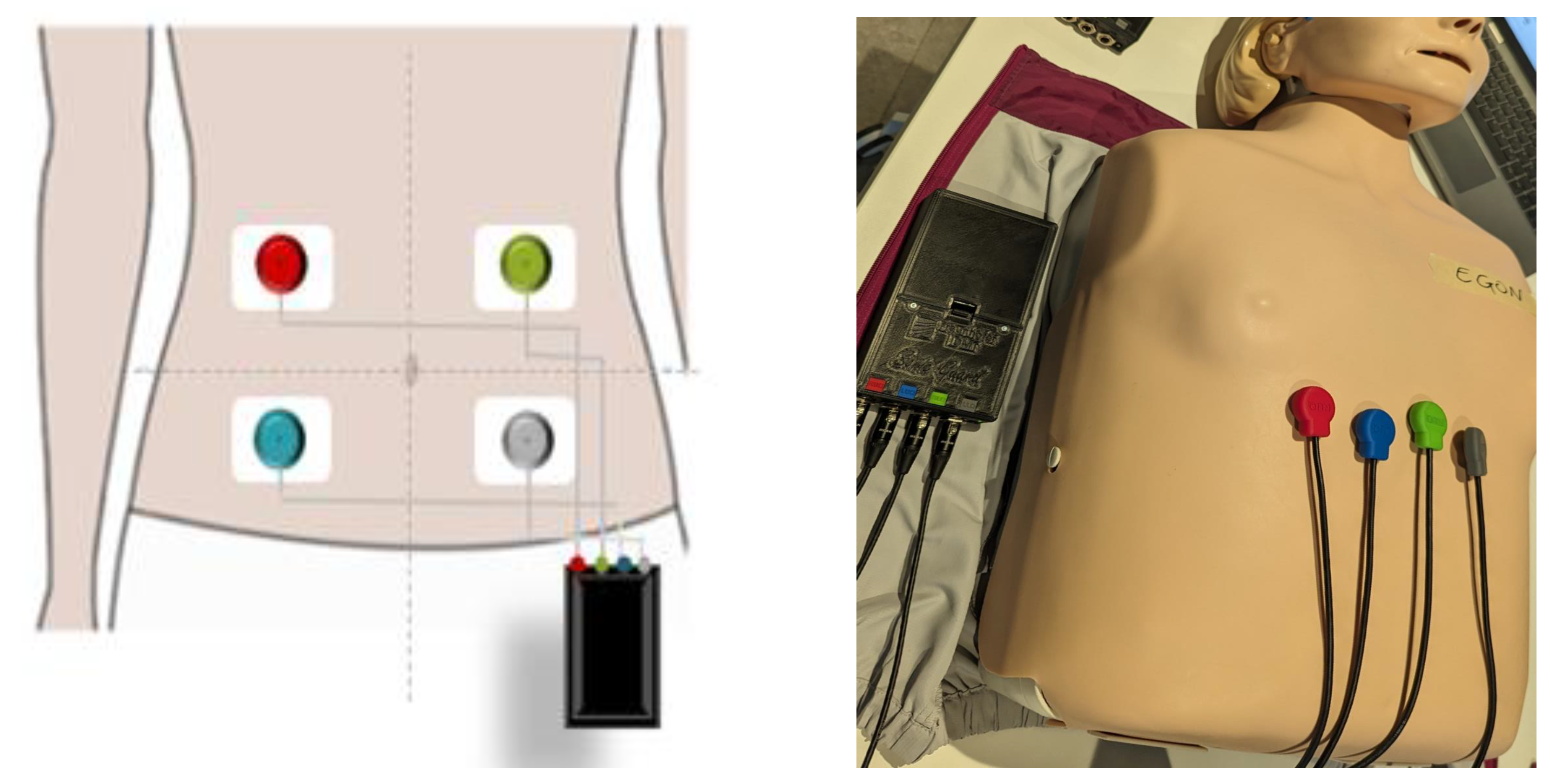 Sensors 24 01843 g0a1