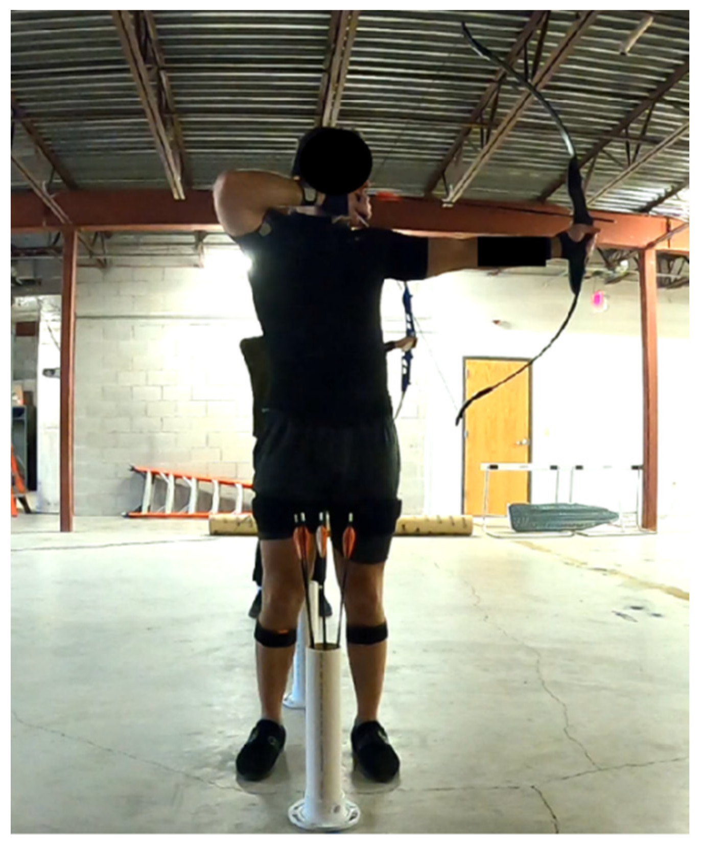 Sensors 24 01862 g003