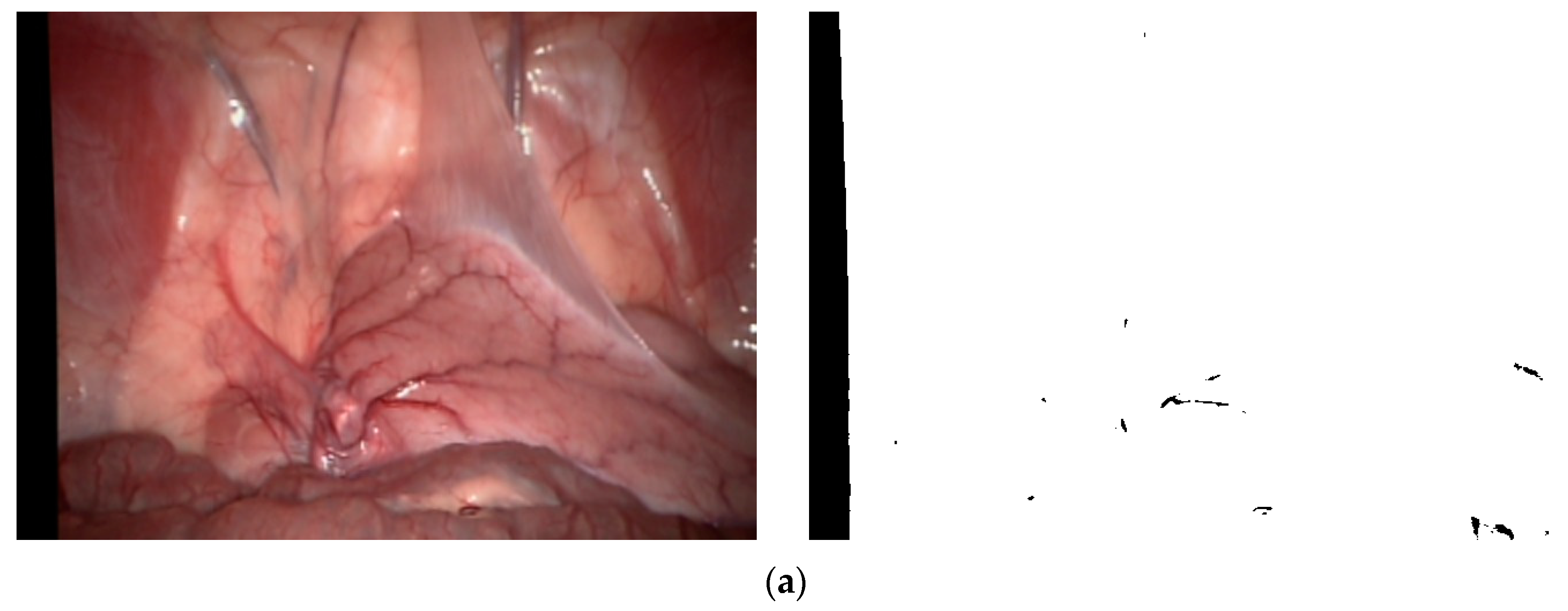 Sensors 24 01880 g003a