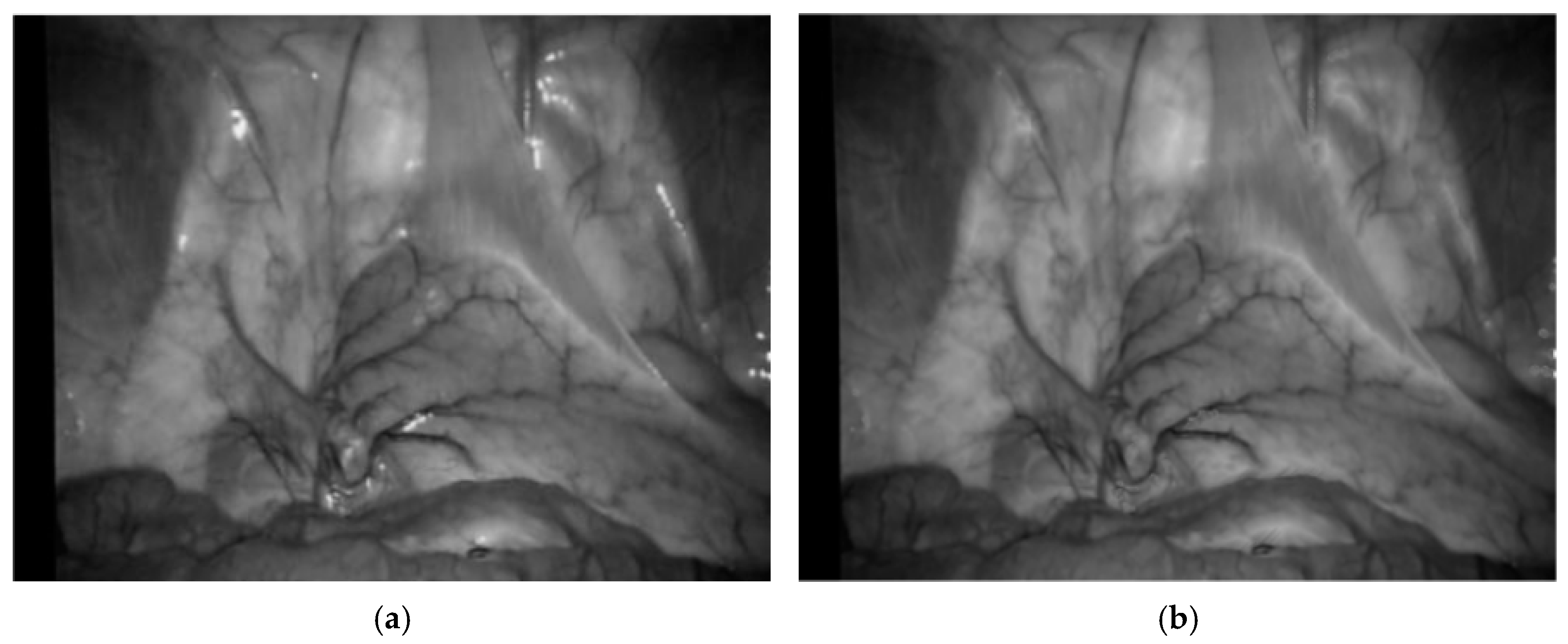 Sensors 24 01880 g005