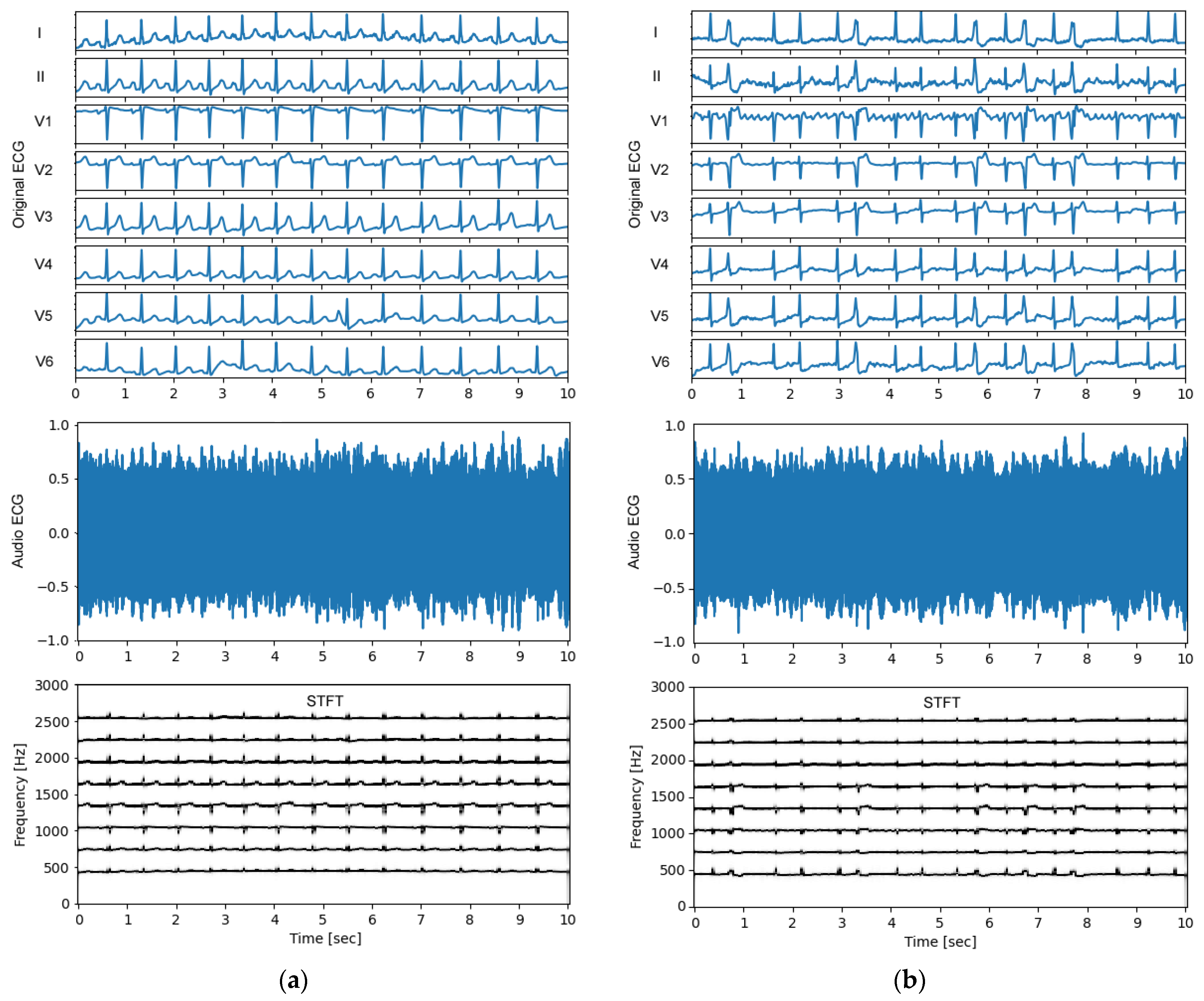 Sensors 24 01883 g004