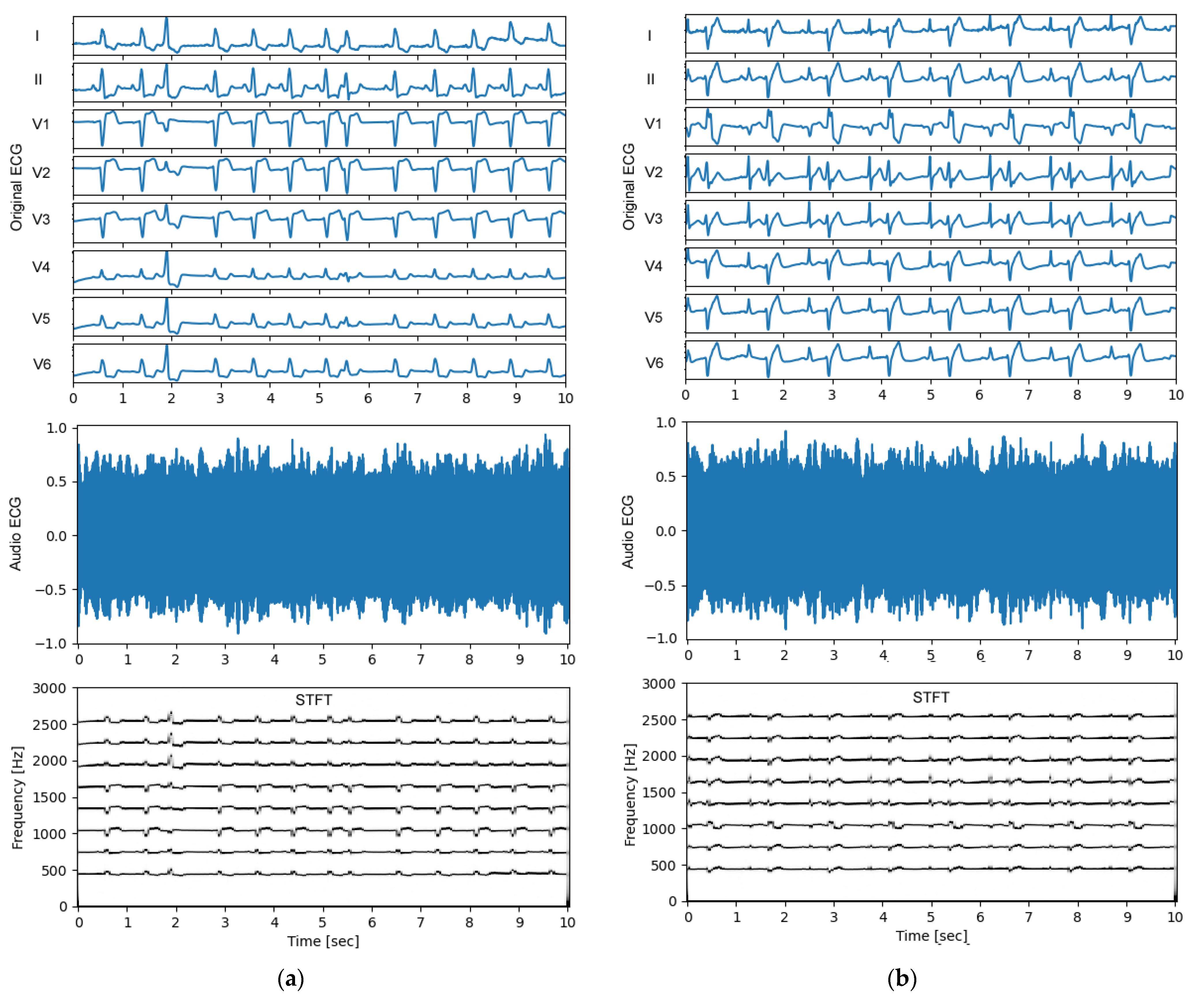 Sensors 24 01883 g005