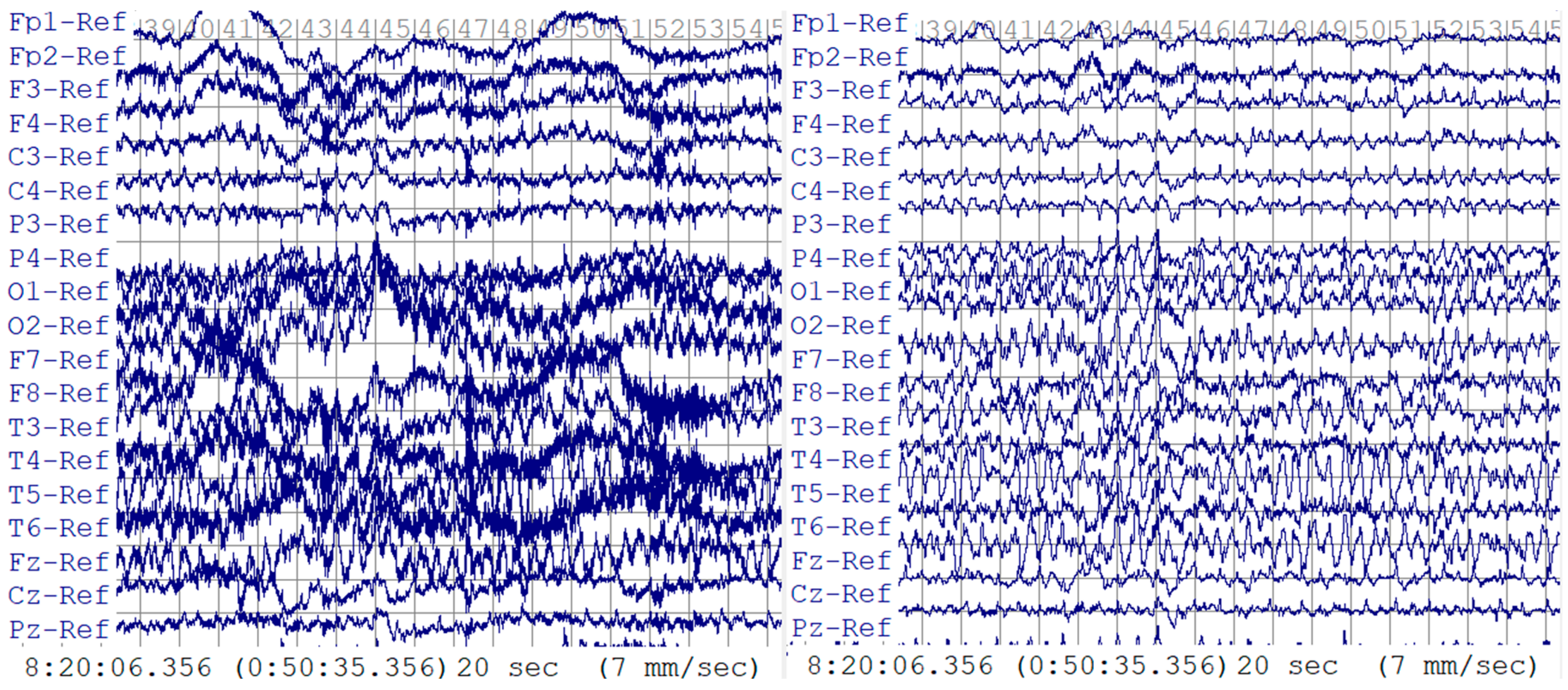Sensors 24 01902 g003