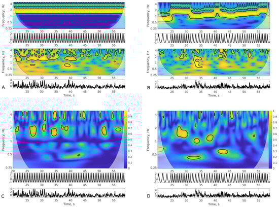 Sensors 24 01994 g0a1