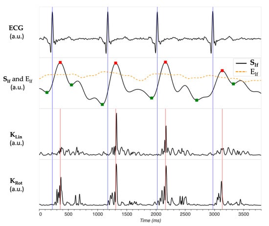 Sensors 24 02139 g0a1
