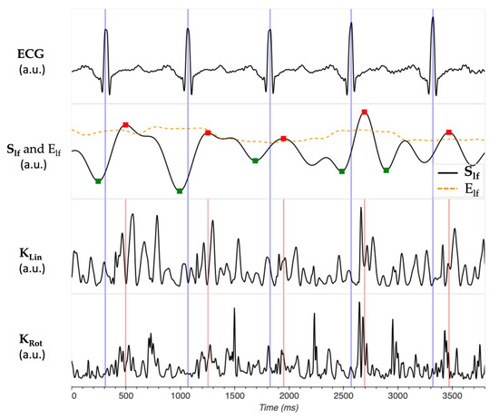 Sensors 24 02139 g0a3