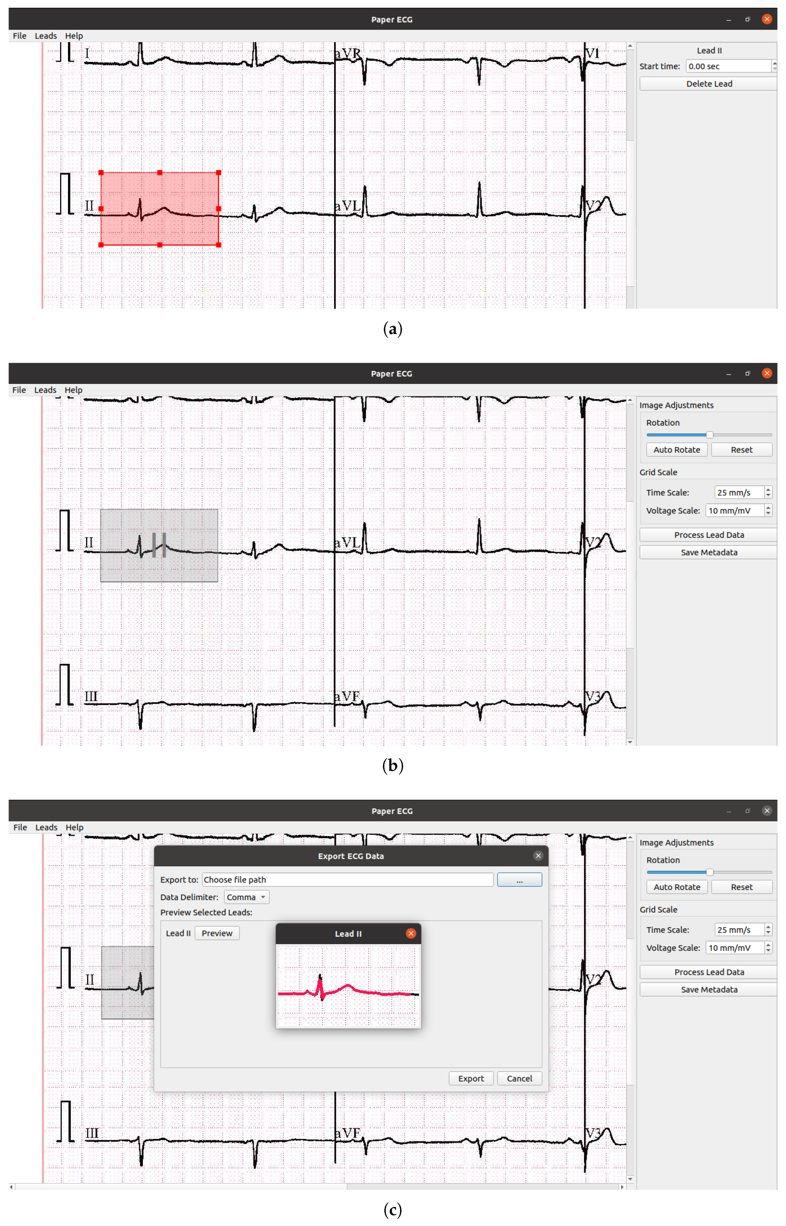 Sensors 24 02484 g005