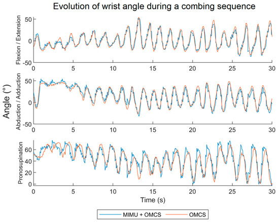 Sensors 24 02543 g0a1