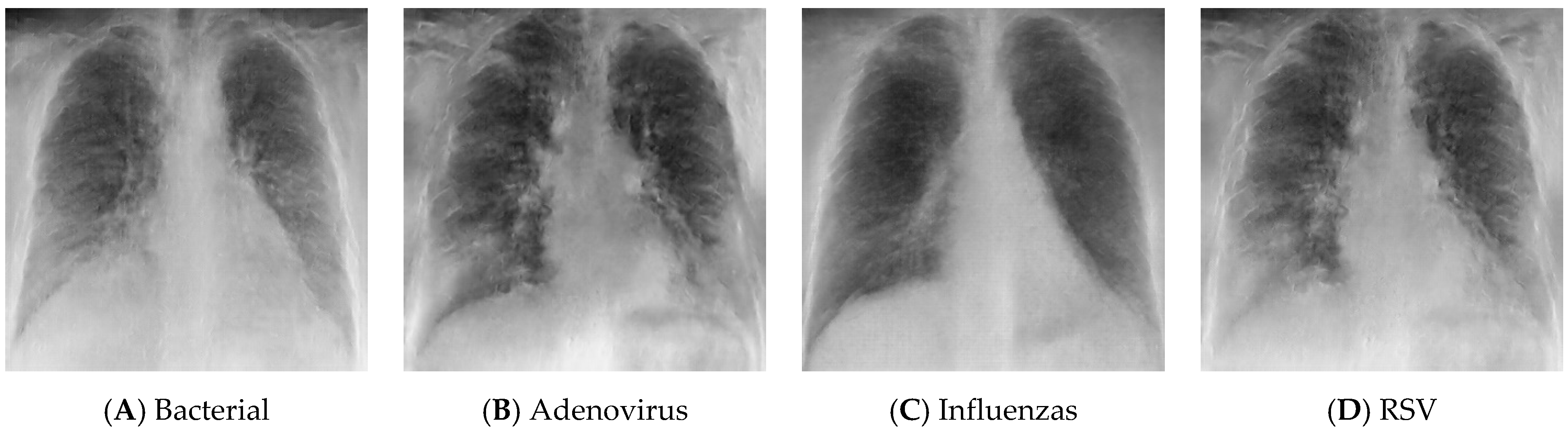 Sensors 24 02641 g007