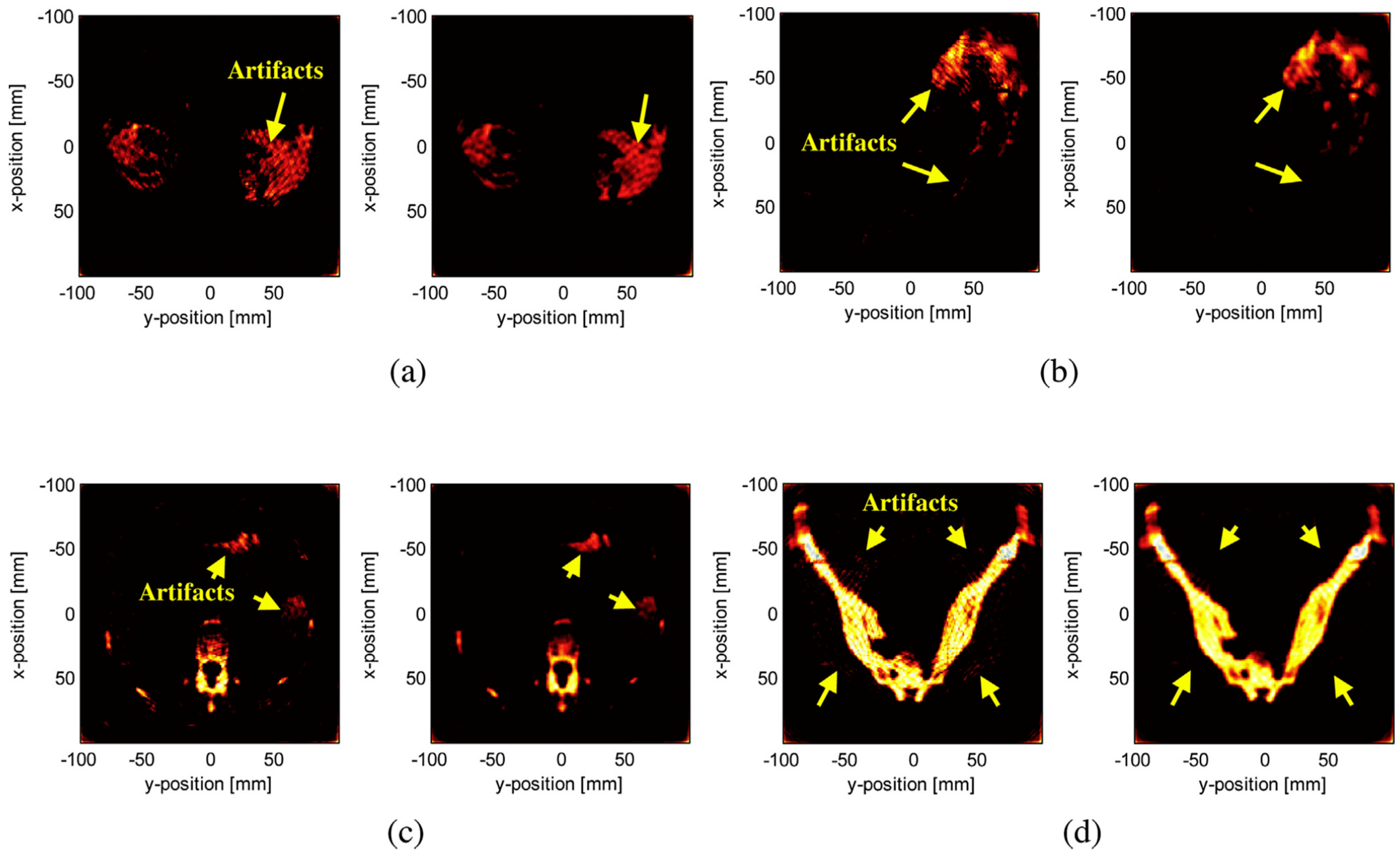 Sensors 24 02670 g007