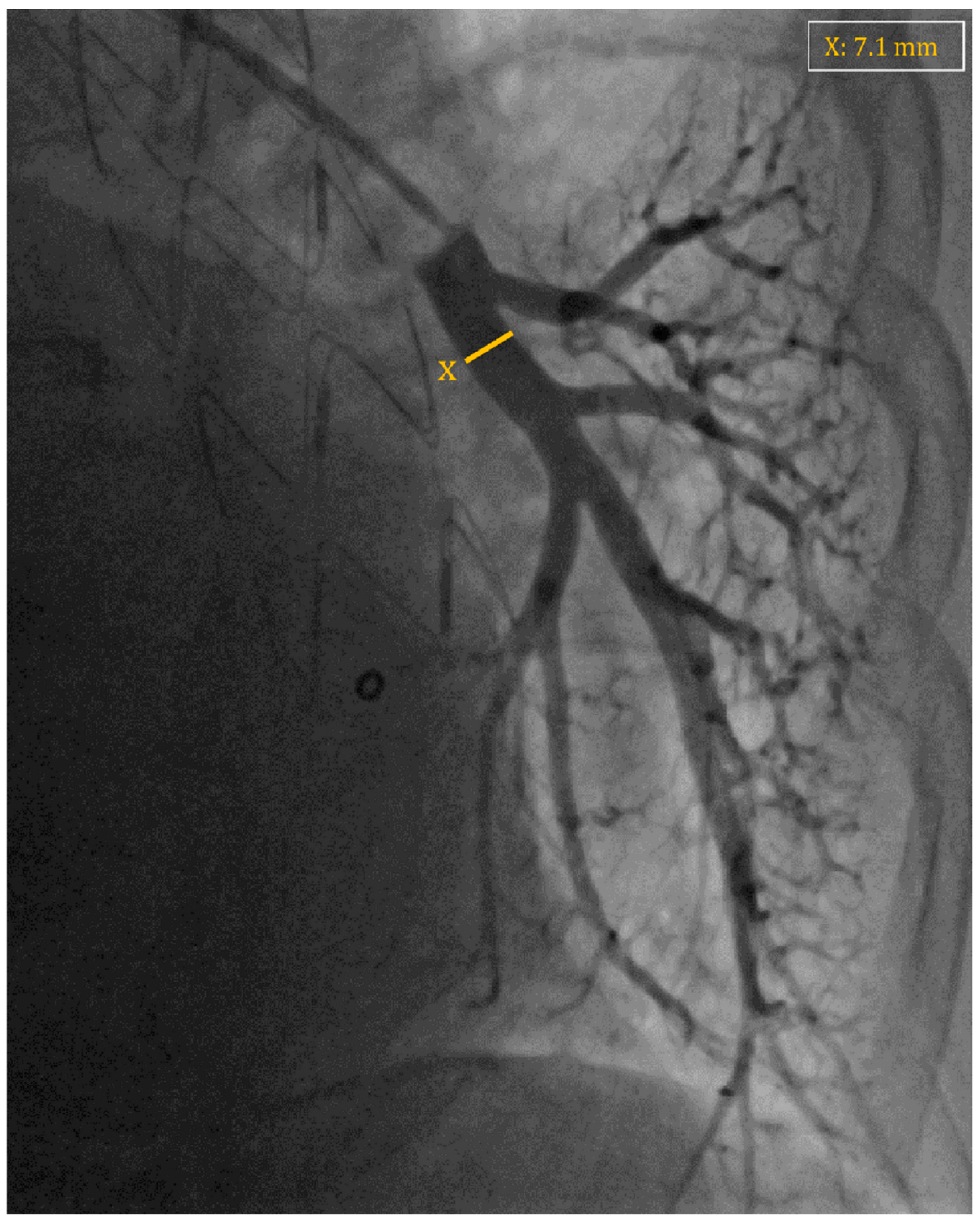 Sensors 24 02922 g003