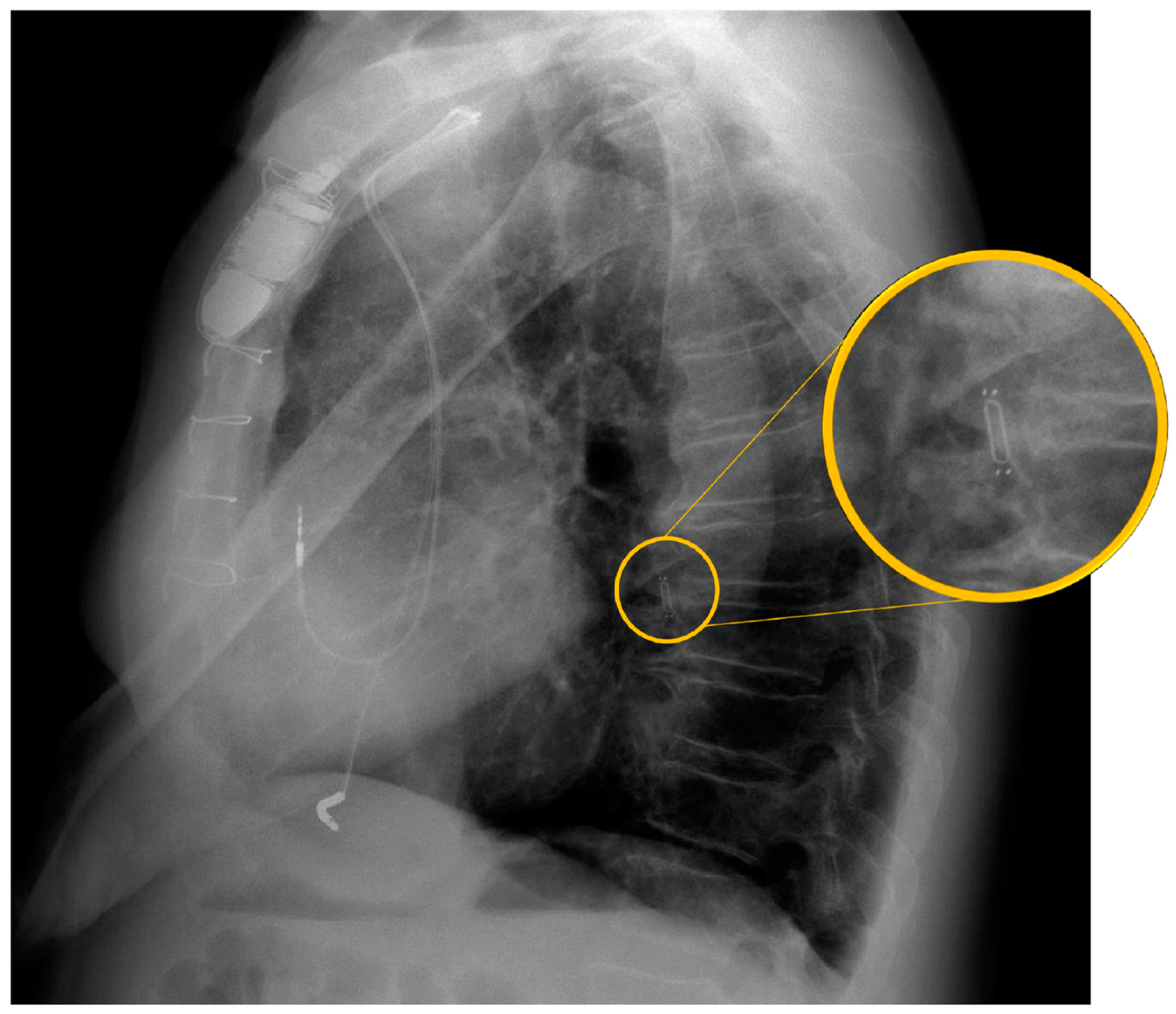 Sensors 24 02922 g004