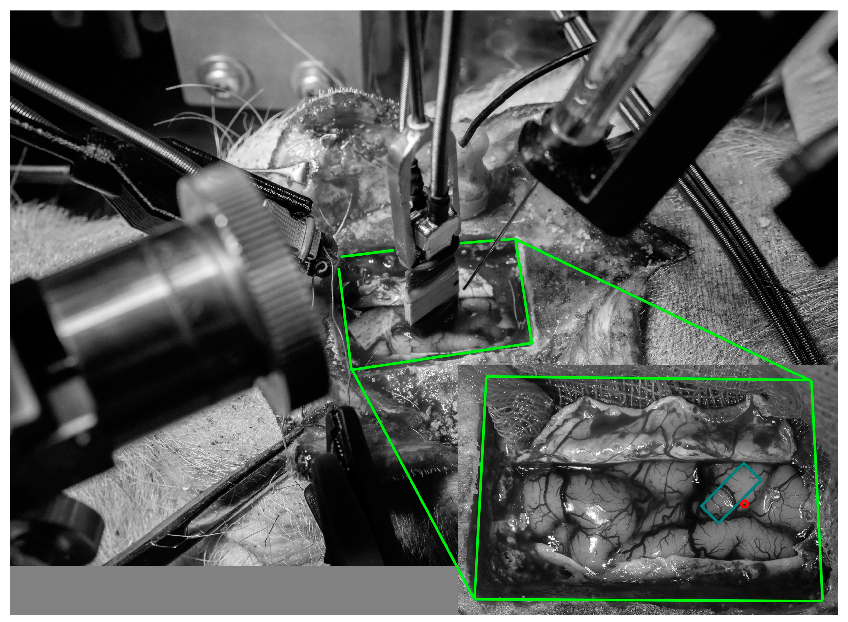 Sensors 24 02967 g001