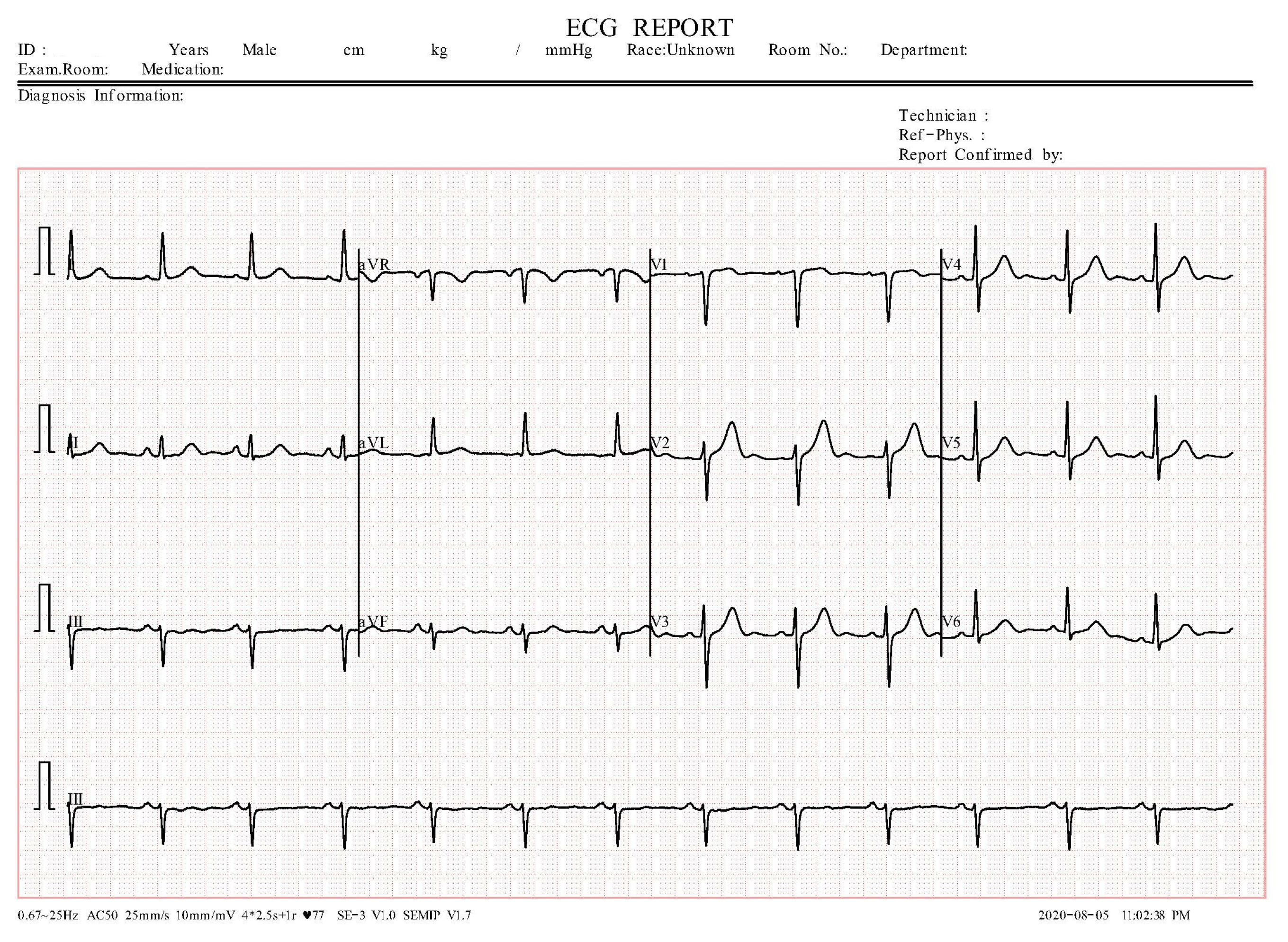 Sensors 24 03485 g001