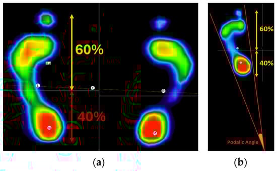 Sensors 24 03646 g007