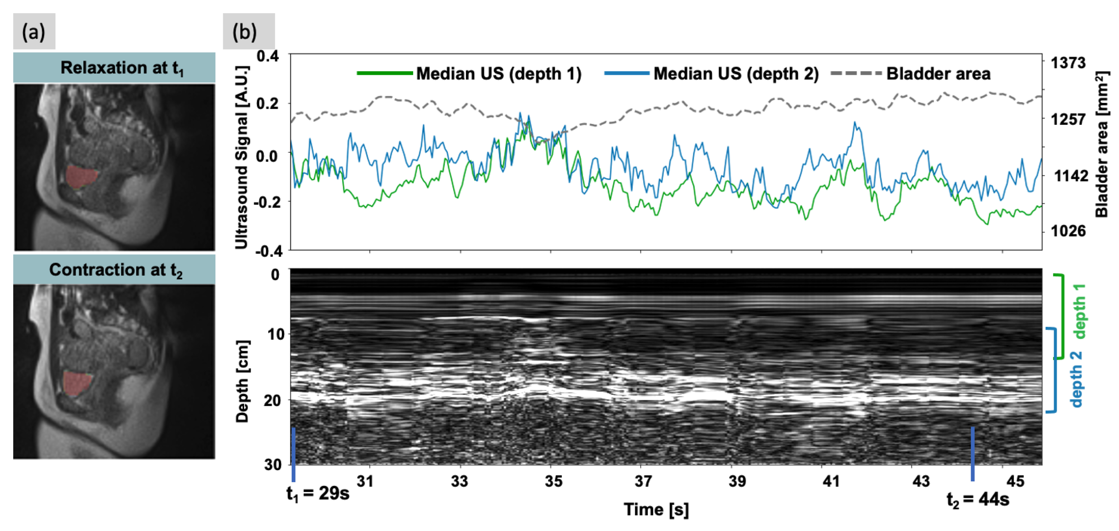 Sensors 24 03710 g005