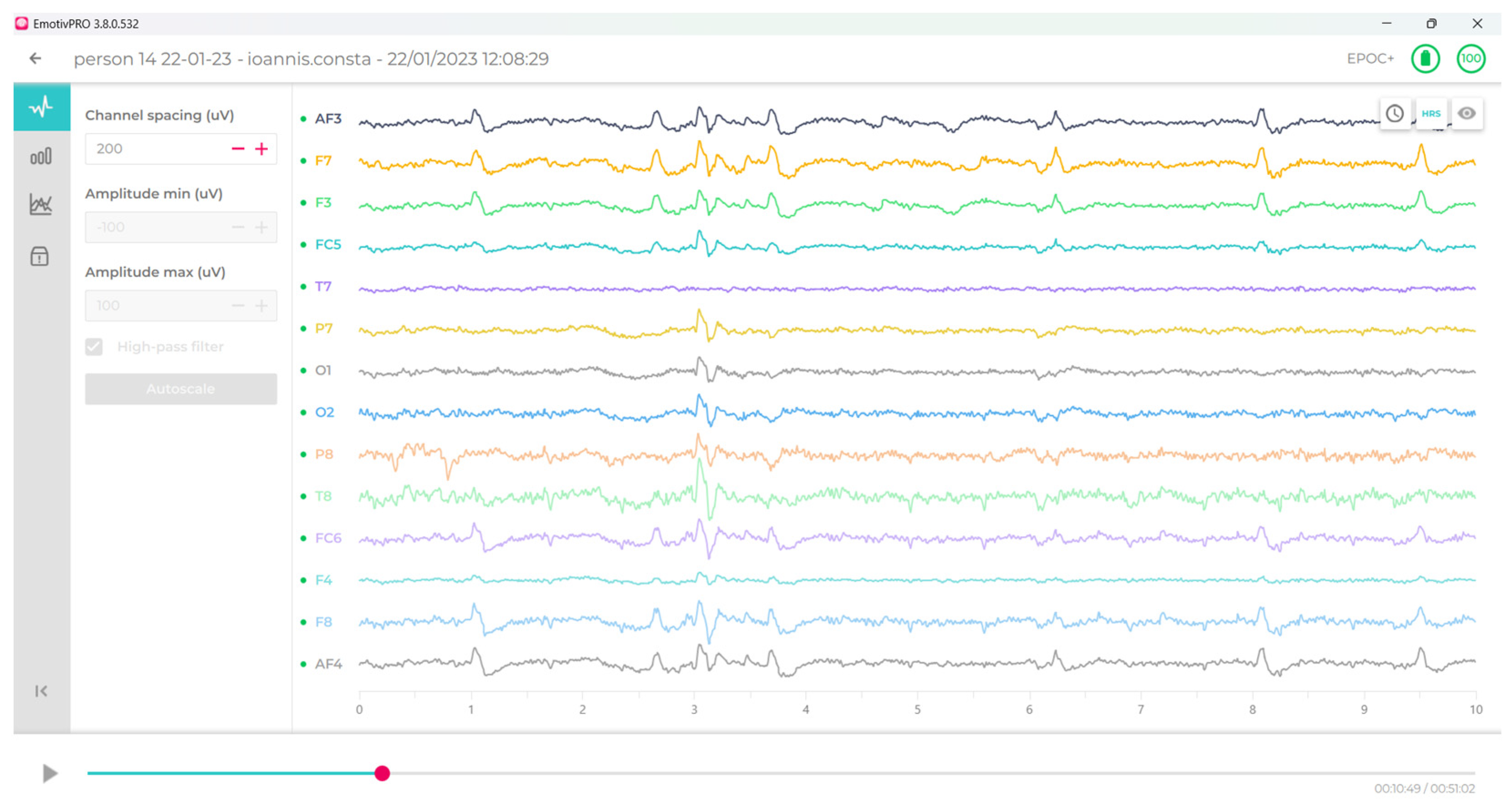 Sensors 24 04297 g004 Sensors 24 04297 g004