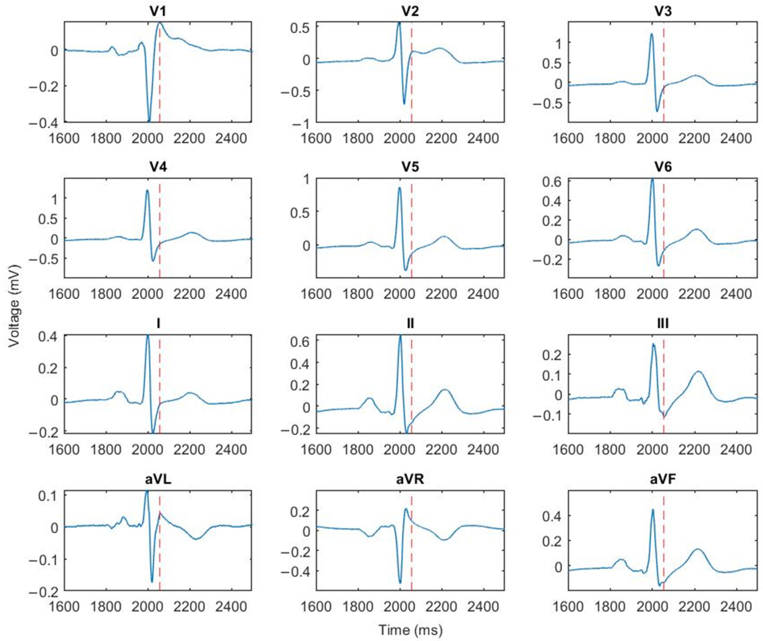 Sensors 24 04342 g008