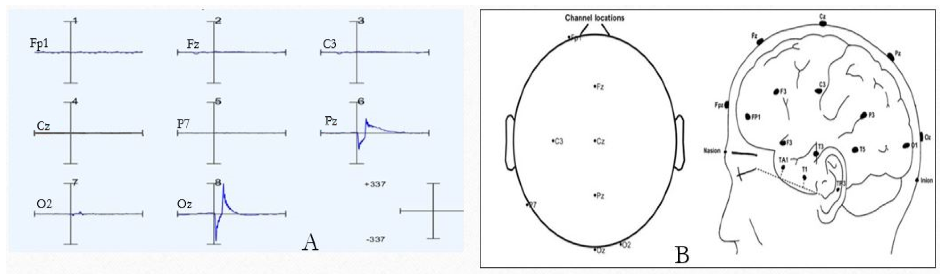Sensors 24 04829 g009 Sensors 24 04829 g009