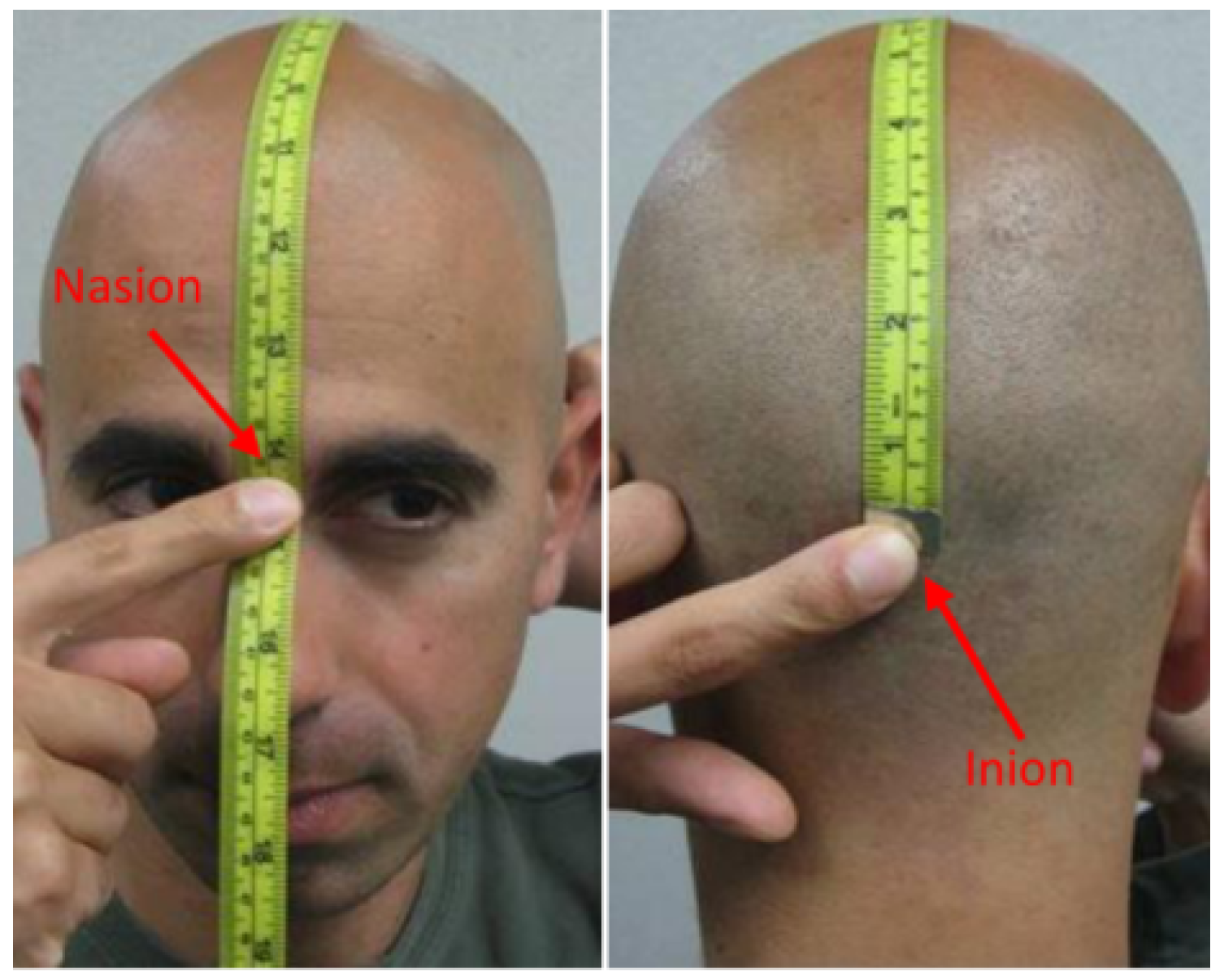 Sensors 24 05363 g011