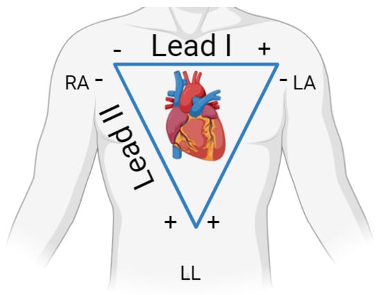 Sensors 24 05544 g0a1