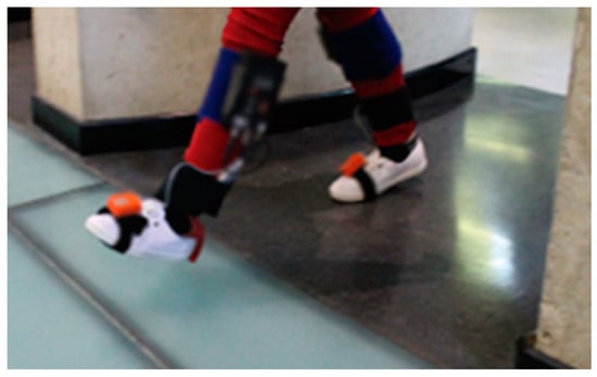 Sensors 24 05579 g0a4