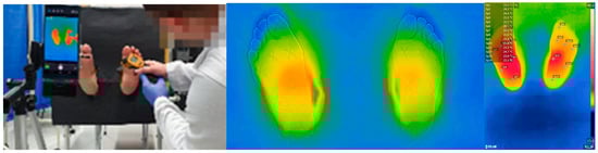 Sensors 24 05579 g0a7