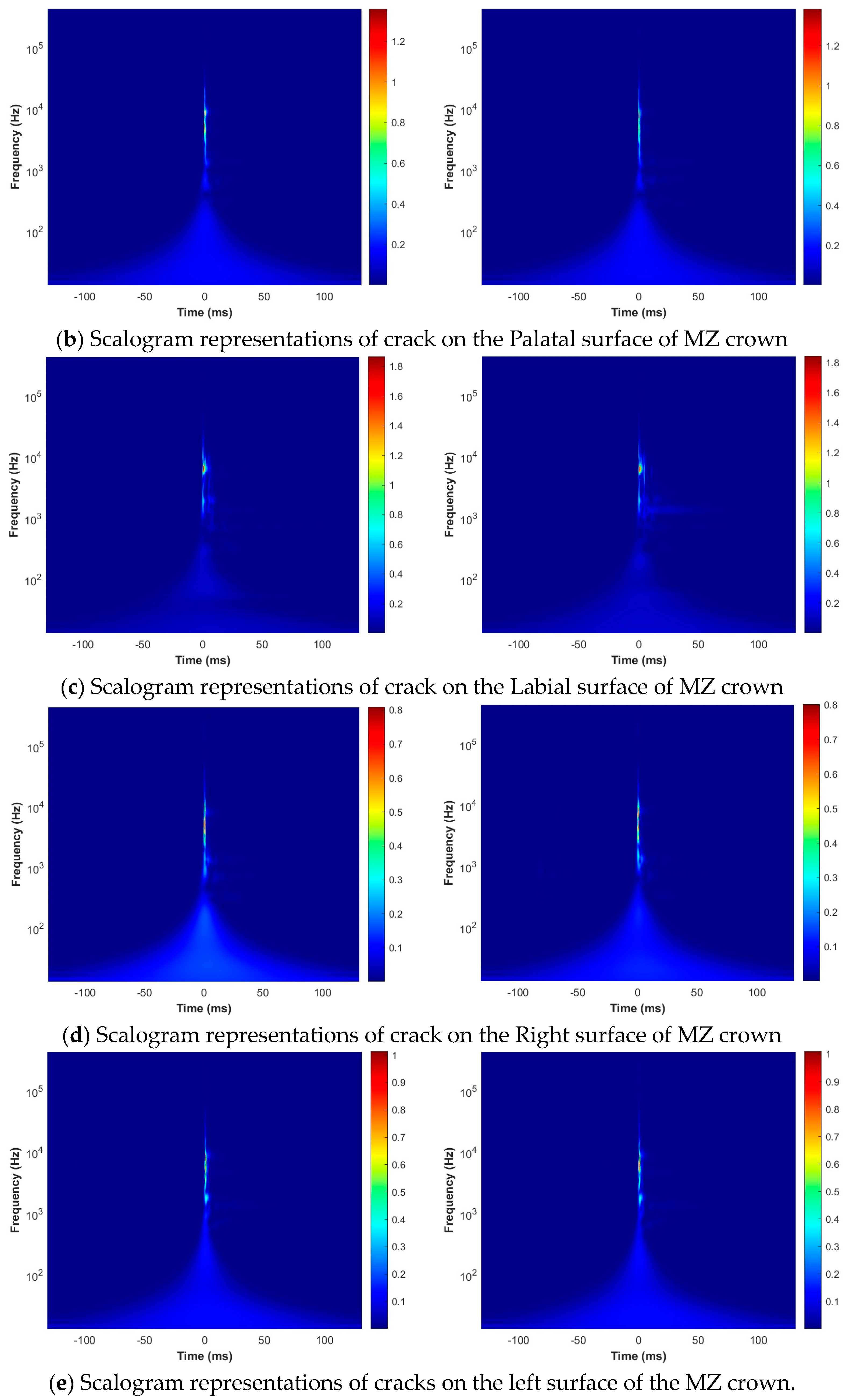 Sensors 24 05682 g007b