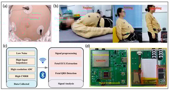Sensors 24 06066 g002