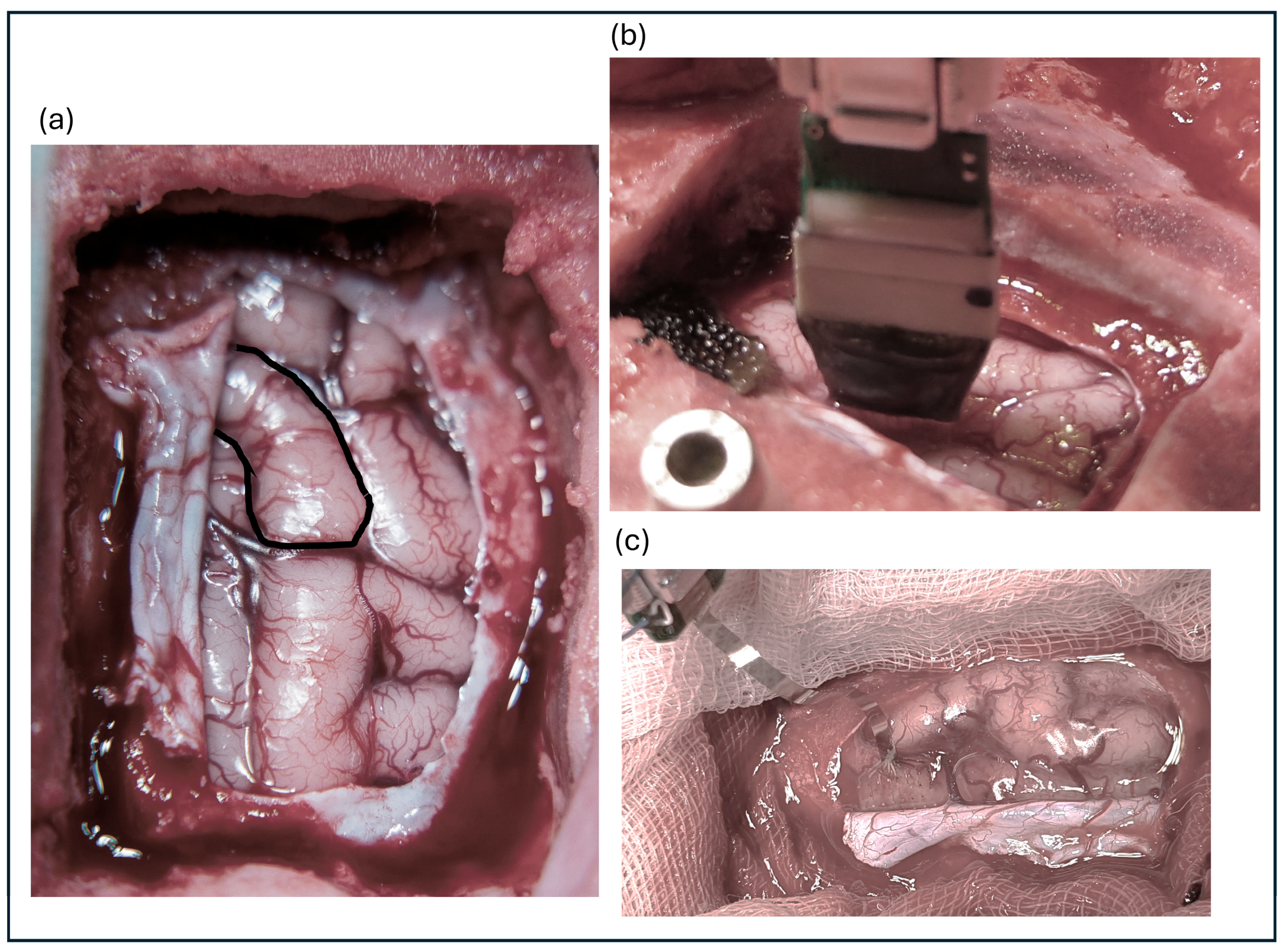 Sensors 24 06847 g001