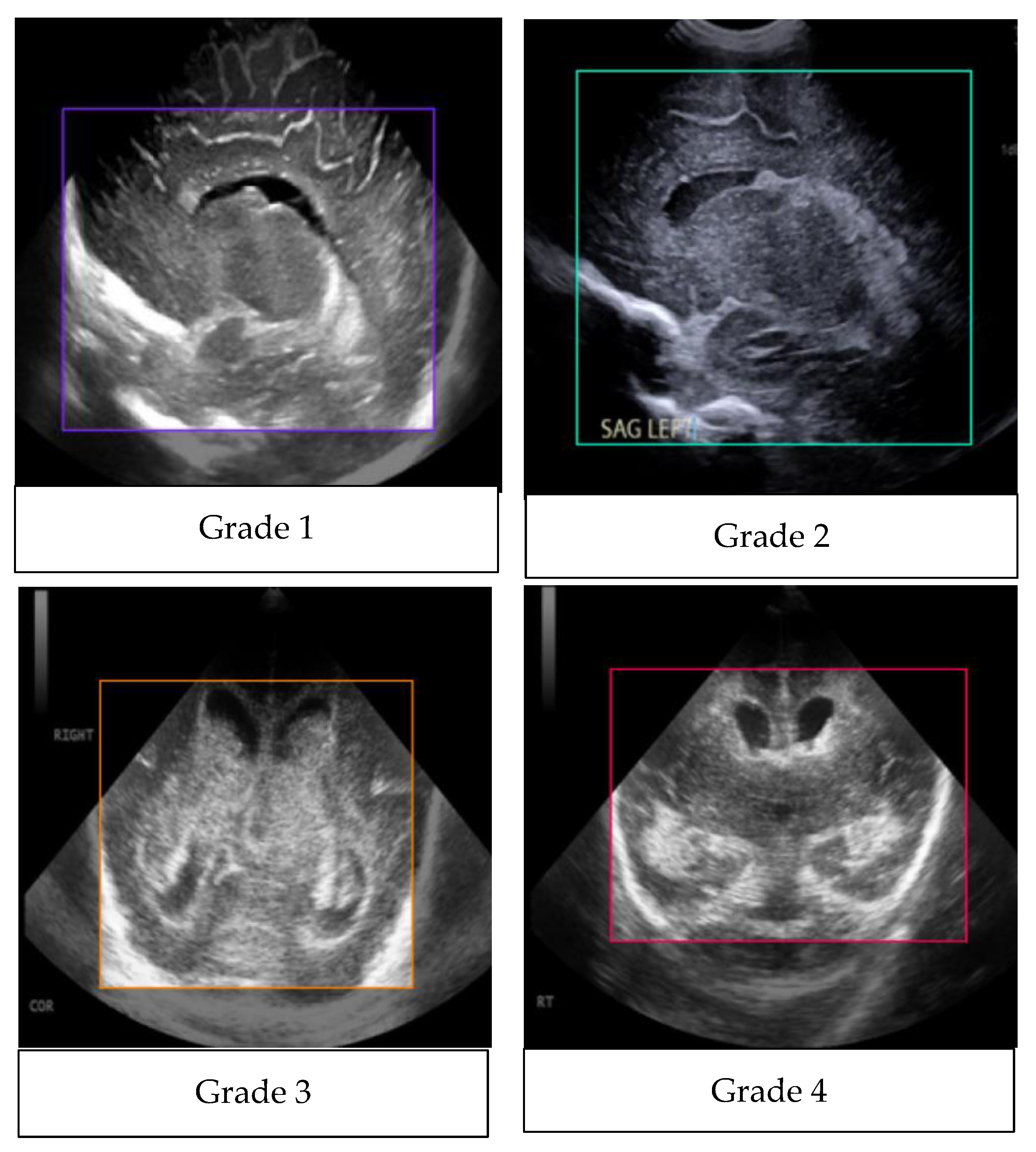 Sensors 24 07052 g014