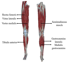 Sensors 24 07087 i001