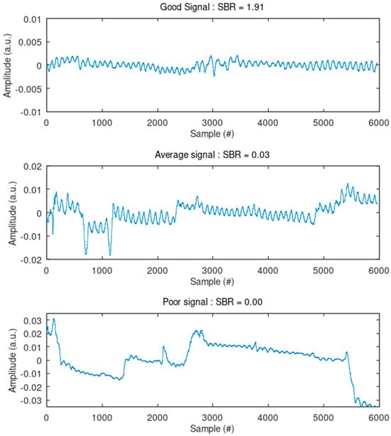 Sensors 24 07483 g0a1