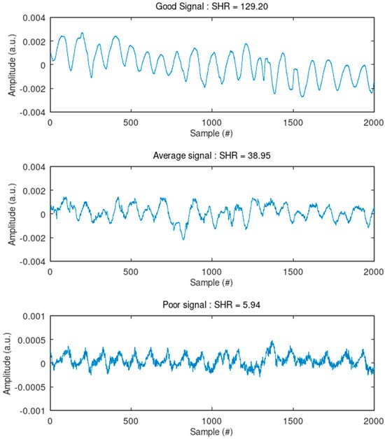 Sensors 24 07483 g0a2