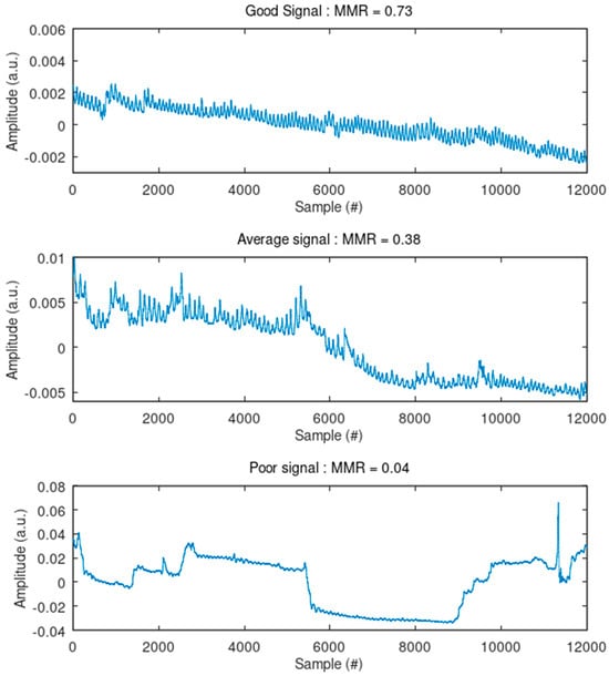 Sensors 24 07483 g0a3