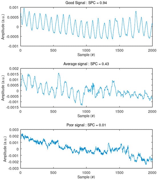 Sensors 24 07483 g0a4