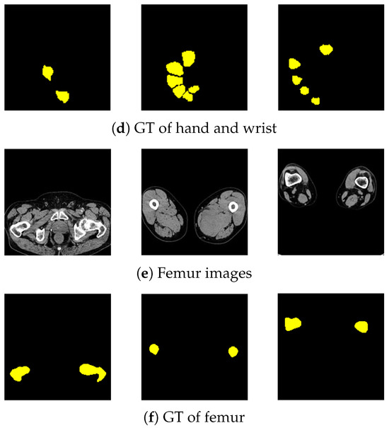 Sensors 25 00081 g0a1b