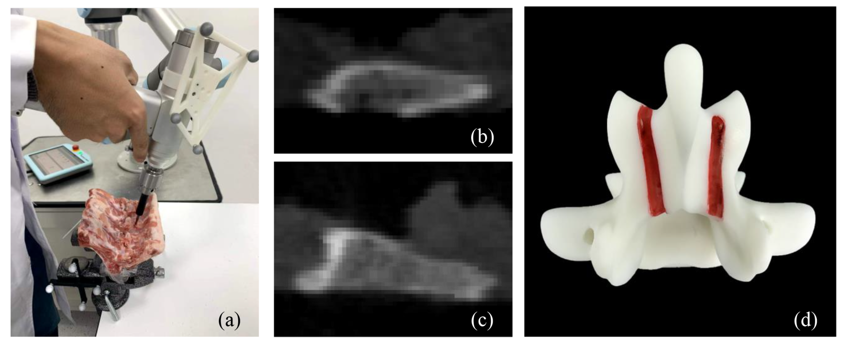 Sensors 25 00238 g011