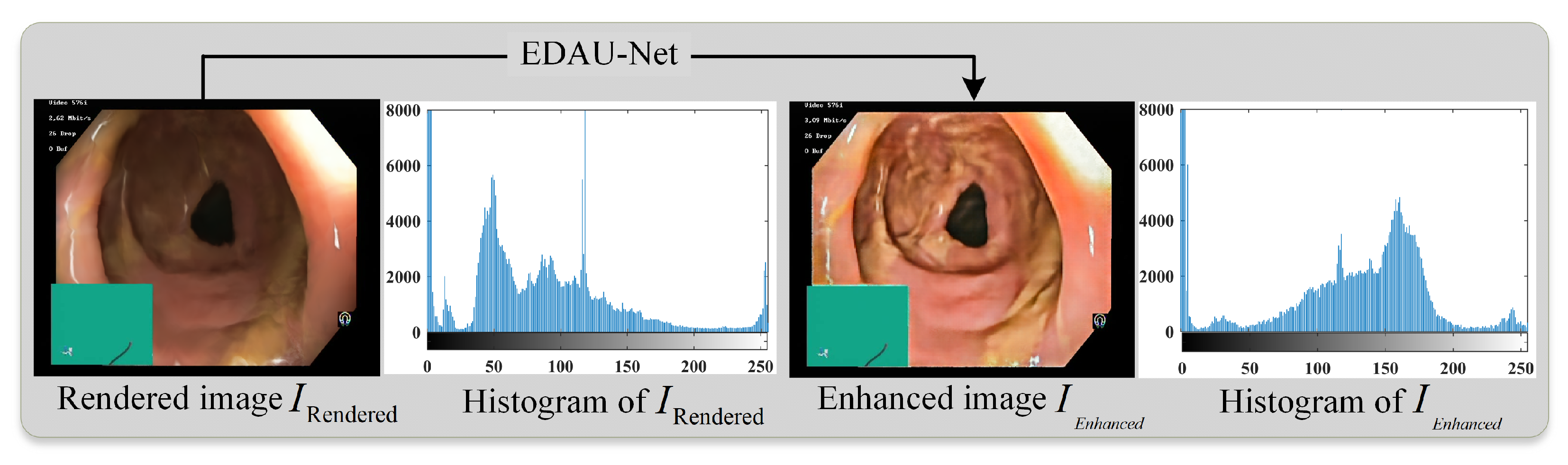 Sensors 25 00565 g005