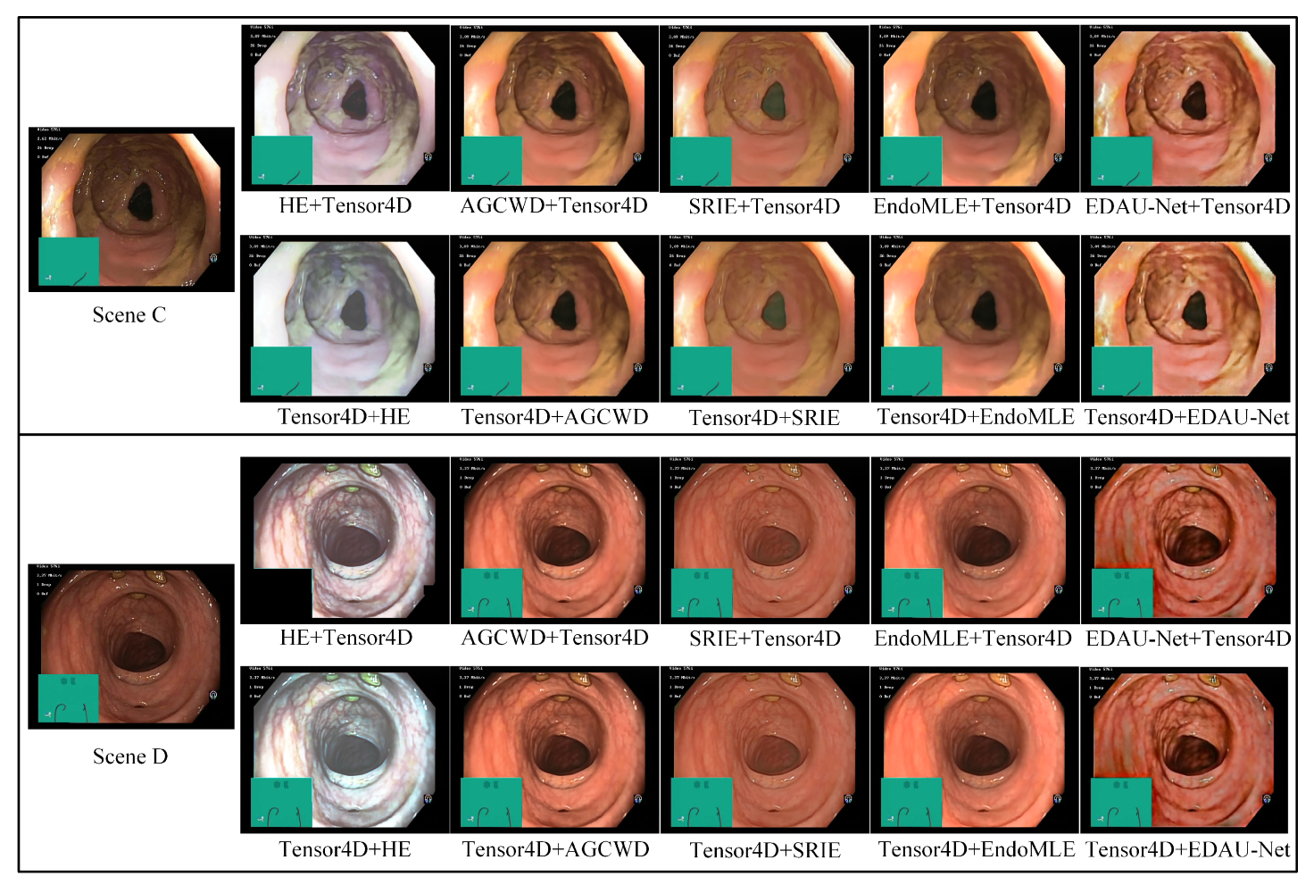 Sensors 25 00565 g009