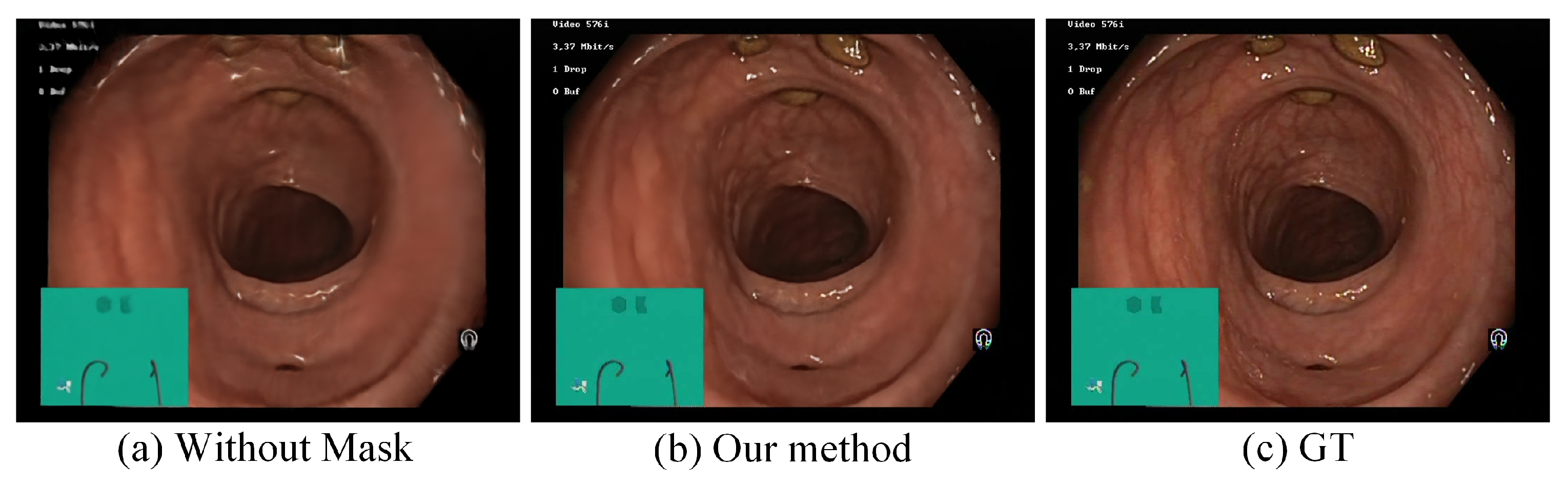 Sensors 25 00565 g010