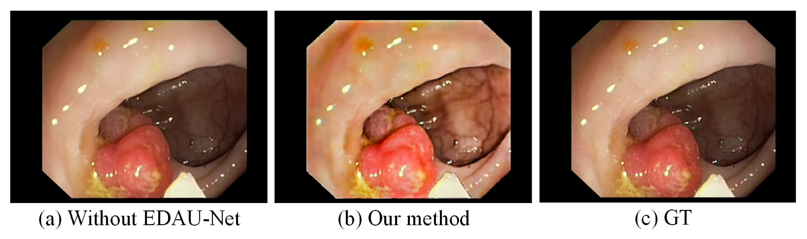 Sensors 25 00565 g011